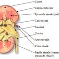 Les calculs rénaux