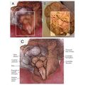 Brainstem, Spinal Cord Images Hidden in Michelangelo's Sistine Chapel Fresco