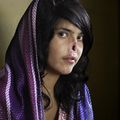 Le World Press Photo Award pour le portrait de l'Afghane défigurée