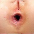 2020: "Anus horribilis"