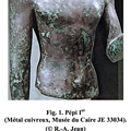 ABDOMEN - I