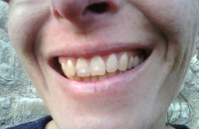 Mes dents moins jaunes grâce à l'argile verte !