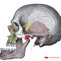 Tumeur et non condylectomie