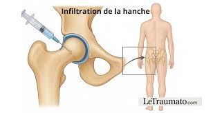 De retour de la clinique Vinci...