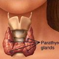 Connasse de thyroïde