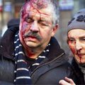 Bạo lực leo thang tại Ukraine