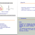 ECG