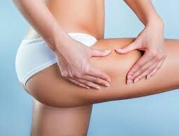 La cellulite, vous connaissez ?