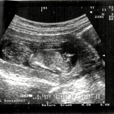 Nous partîmes quatre...