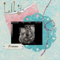 Echographie 4D : Lily a 24 semaines