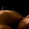 Welcome to Rohr Acupuncture!