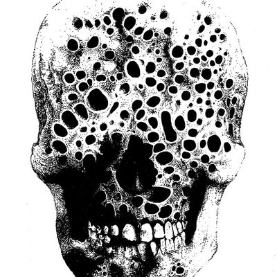 Trypophobia