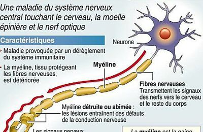 Sep, définition