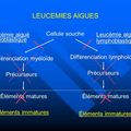 La Leucémie aiguë myéloblastique