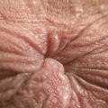 2020: "Anus horribilis"