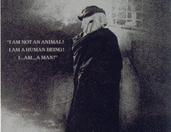 1. Elephant Man: l'histoire de John Merrick