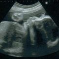 Le ptit boy - RDV des 7ème et 8ème mois + photos des 7 mois de grossesse !!!!
