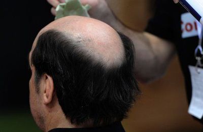 Un produit suisse de repousse des cheveux retiré du marché italien