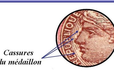 Cassures du médaillon sur la série ordinaire de la SFU