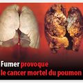 FUMER EST PRÉJUDICIABLE A LA SANTÉ !