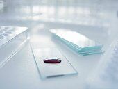 Les différents parasites sanguins Partie 1 la Babésiose ou Piroplasmose