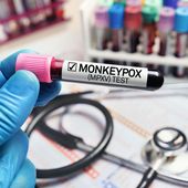 Variole du singe : l'OMS prête à lancer l'alerte rouge
