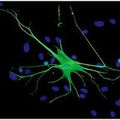 Rôle primordial des astrocytes dans la pensée humaine