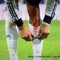 Cristiano Ronaldo a fini le jeu et que sa jambe est rempli de sang