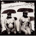 Joel-Peter WITKIN, I.D. Photographs from Purgatory, two women with stomac irritations, New Mexico, 1982