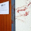 Allemagne: Une Africaine (41 ans) tuée par son fils (17 ans) à coups de couteau