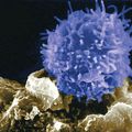 VIH: Découverte du mécanisme de l'IRIS (syndrome inflammatoire de reconstitution immunitaire)