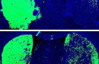 Des chercheurs inversent la maladie de Parkinson chez la souris !