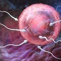 Solutions Infertilité Masculine