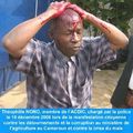 Cameroun- Communiqué : Violences illégales des forces de l’ordre sur les manifestants de l’ACDIC 