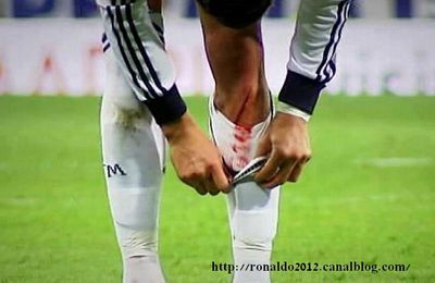 Cristiano Ronaldo a fini le jeu et que sa jambe est rempli de sang