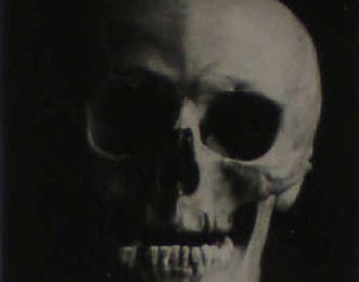 Brassaï (Attribué à) - Tête de mort, circa 1930