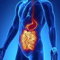 La Maladie de Crohn 