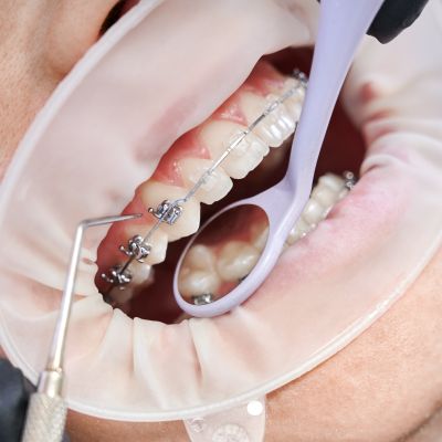 Trouvez un Dentiste de Confiance à Casablanca