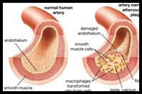 DYSFONCTION ENDOTHELIALE ET METAUX LOURDS TOXIQUES