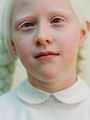 Les animaux albinos 