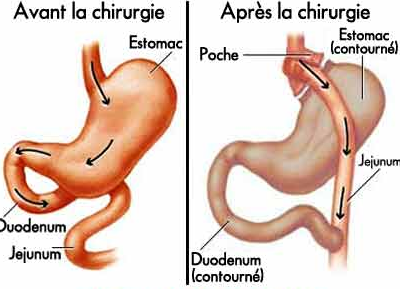 2ème rendez-vous: 12/10/2010