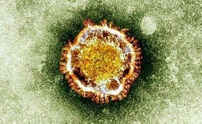 Coronavirus: l'OMS tire la sonnette d'alarme