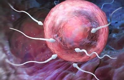 Solutions Infertilité Masculine