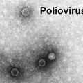 Poliomyélite vs glioblastome?