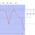 Evaluation du temps d'un parcours de randonnée .