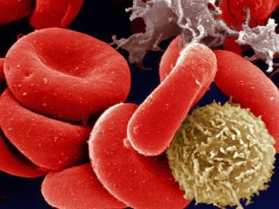 870 - Une histoire de plaquettes