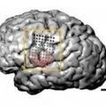 Une expérience qui repousse les limites de la plasticité du cerveau humain 