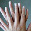 Las uñas son un reflejo de nuestra salud