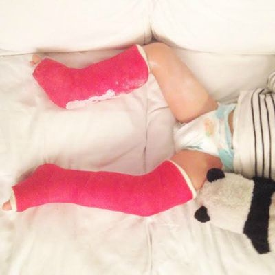 Aujourd'hui Adèle s'est cassé la jambe gauche. On