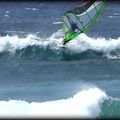 WIND-SURFER L'EPAULE !...